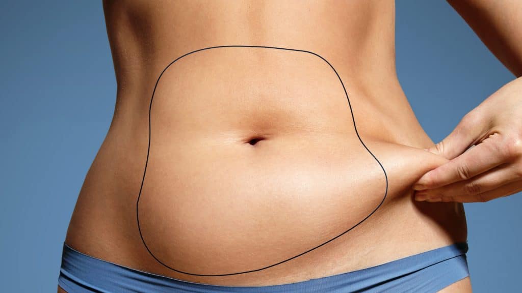 Liposuccion abdominale du ventre 