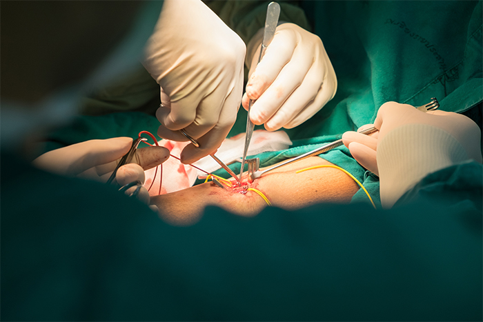 Chirurgie Veineuse & Cardiaque