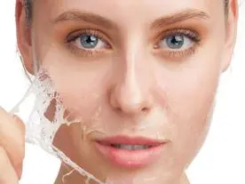  Infos et prix Peeling chimique