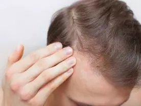  Información & precios Tratamiento hormonal para la caída del cabello