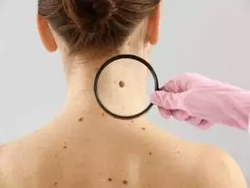  Info, prices & total cost Excisions of Skin Cancer