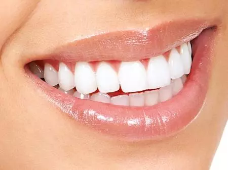  Teeth whitening