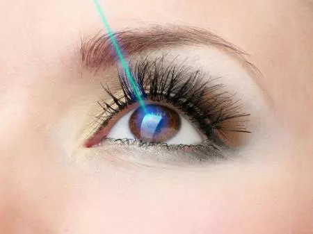  Лазерная хирургия глаза Ласик