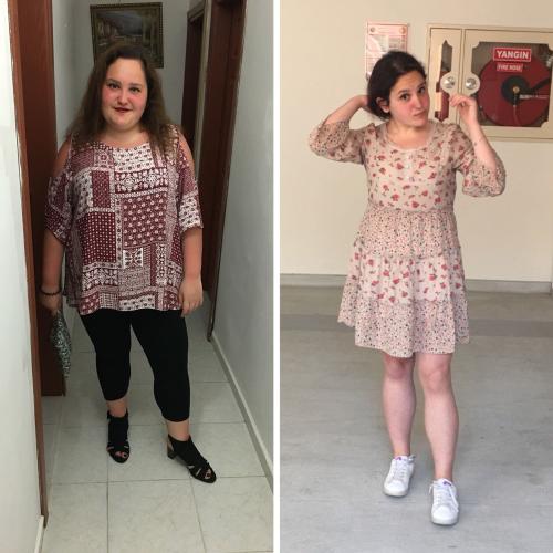 صور قبل وبعد لمرضانا 1 عمليات التجميل في تركيا,أفضل مراكز التجميل في تركيا,افضل دكتور تجميل في تركيا,تجربتي,إسطنبول