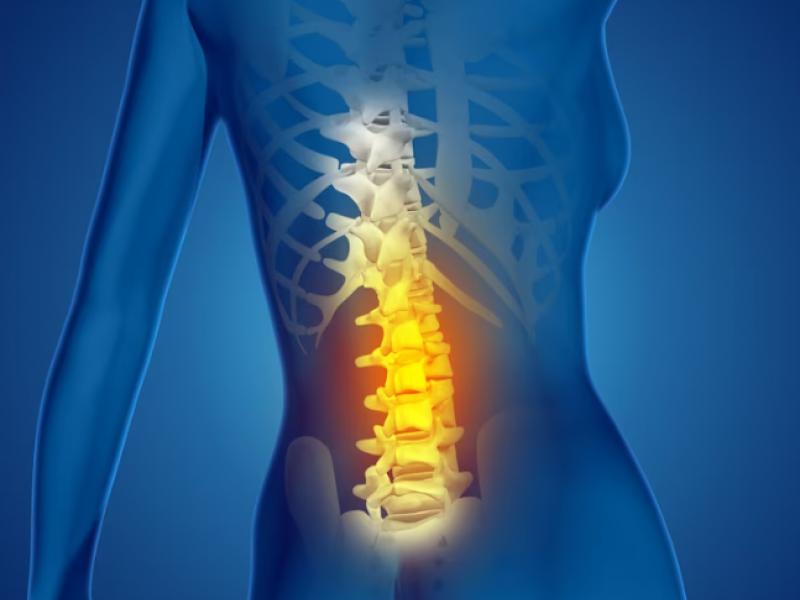 Symptoms of spinal stenosis 2024
