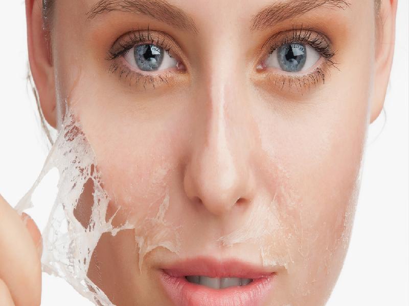 Chemical Peel: A Complete Guide 2024