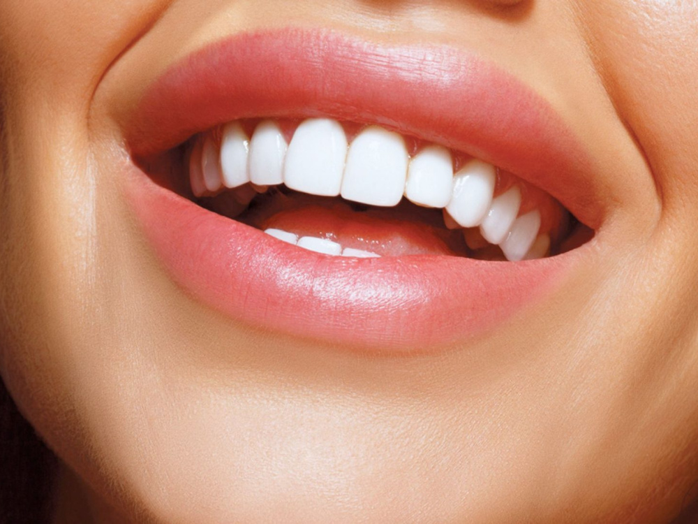 Почему стоит выбрать Голливудскую улыбку? 2026 Почему стоит выбрать Голливудскую улыбку? 2026