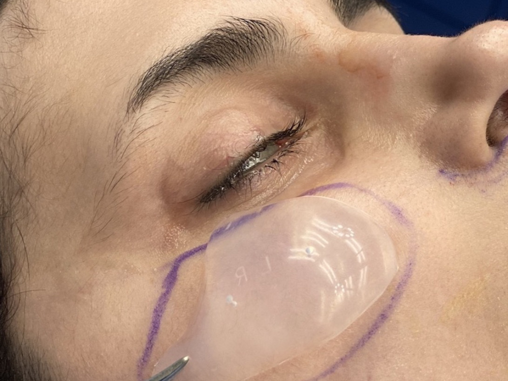 Подготовка к операции в Турции 2026