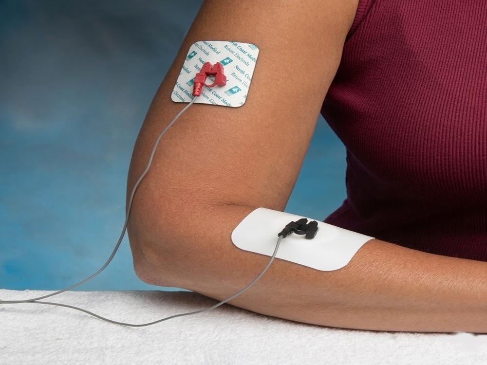 ионтофореза