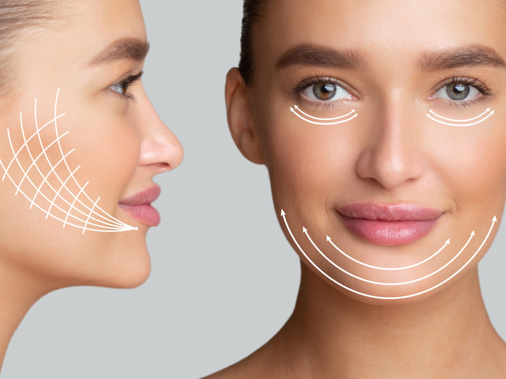 Qu'est-ce qu'un mini lifting du visage ? 2026