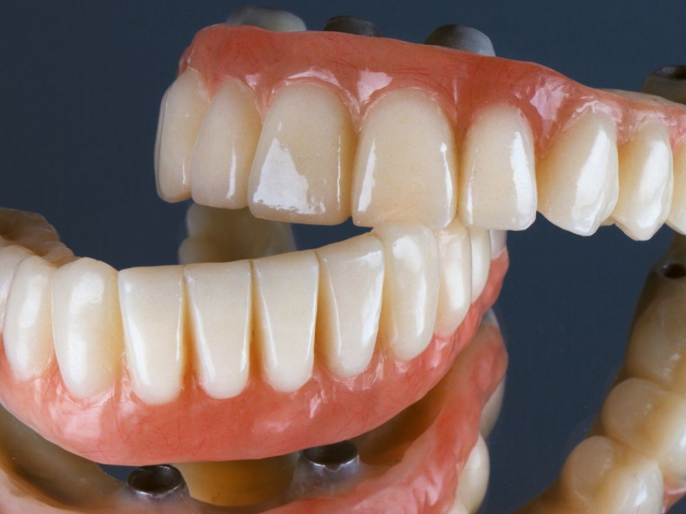 Prothèse dentaire Prothèse dentaire