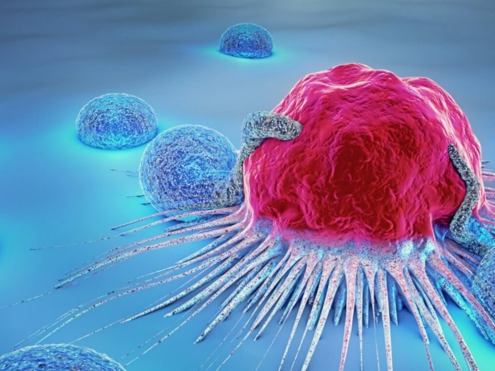 Quels cancers peuvent être traités par la thérapie CAR-T ? 2026 Quels cancers peuvent être traités par la thérapie CAR-T ? 2026