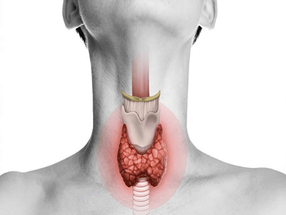 Тиреоидэктомия в Турции
