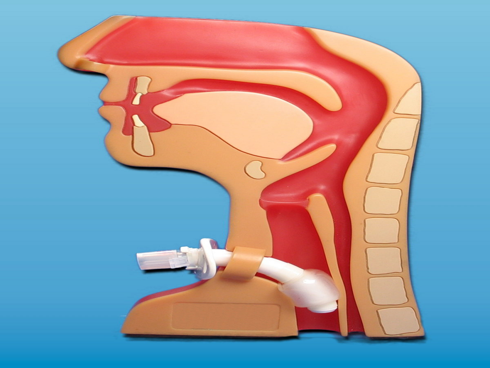 tracheostomy in Turkey