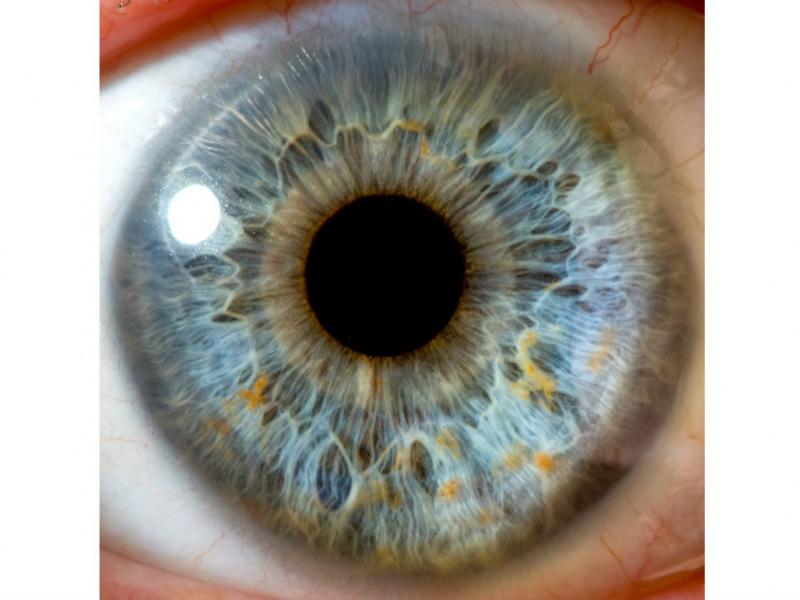 Treatment of Retinitis Pigmentosa Turkey Treatment of Retinitis Pigmentosa Turkey