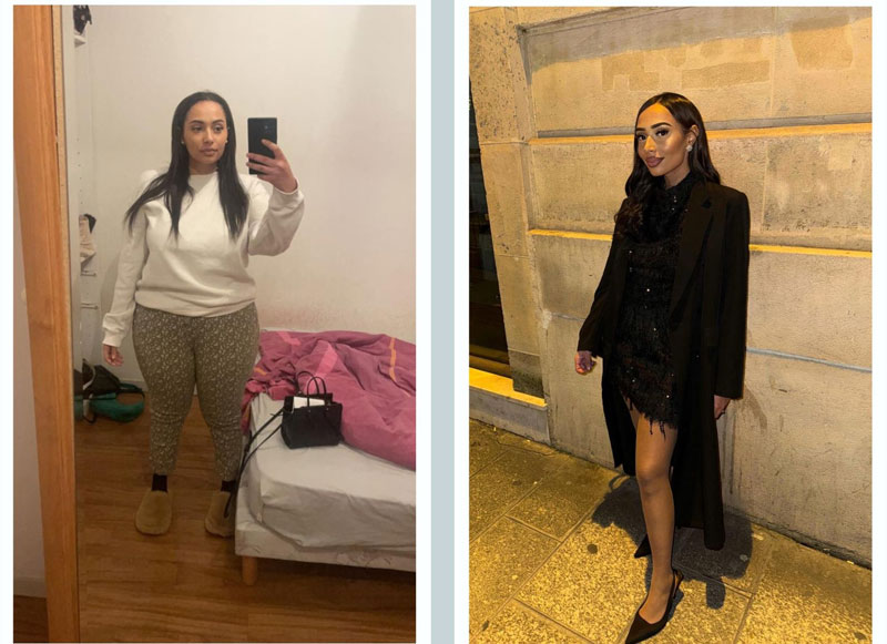 Spectacular transformation: Our patient regains her dream body and her health thanks to gastric sleeve surgery