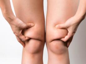 Liposucción de rodilla