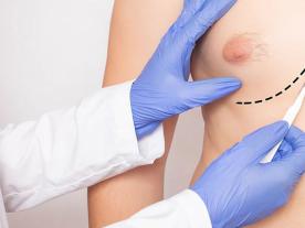 Traitement de la Gynécomastie