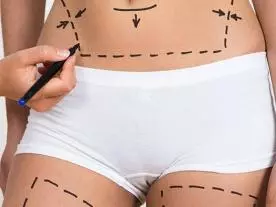  Info, prices & total cost Liposuction