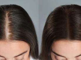 الميزوغراف للشعر