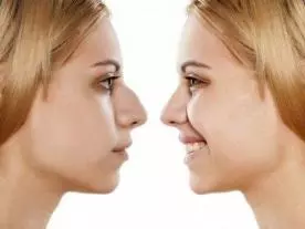  Info, prices & total cost Rhinoplasty