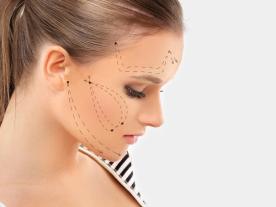 تقنية ذيل الحصان