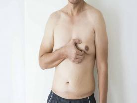  Info, prices & total cost Gynecomastia treatment (with liposuction)