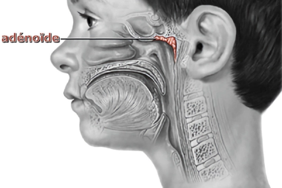 Etiological factors in adenoid hypertrophy 2024