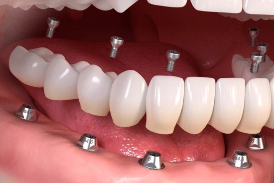 Postoperative care 2026