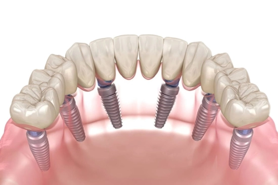 Complementary procedures before placing All on 6 2026