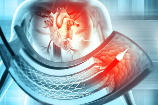 Аортальный стент-графт (EVAR / TEVAR) Турция