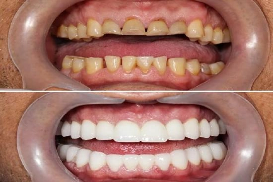 of our patients 5 