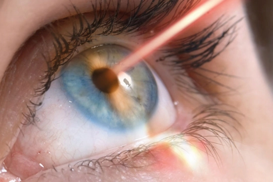 Complications et effets secondaires possibles de la capsulotomie au laser YAG 2026 Complications et effets secondaires possibles de la capsulotomie au laser YAG 2026