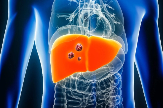 El diagnóstico de los tumores hepáticos: un proceso explicado 2025