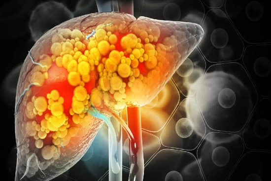 Liver cancer treatments in Turkey 2024