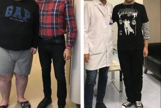 صور قبل وبعد لمرضانا 0 عمليات التجميل في تركيا,أفضل مراكز التجميل في تركيا,افضل دكتور تجميل في تركيا,تجربتي,إسطنبول