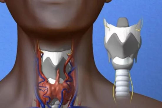 Chirurgie du larynx 