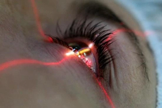 LASIK eye surgery in Turkey