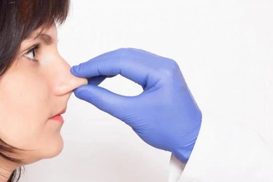 Métodos utilizados para corregir malformaciones nasales 2024