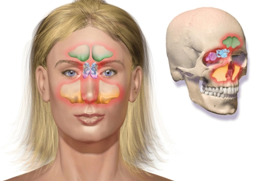 Diagnosis of sinusitis in Turkey 2024