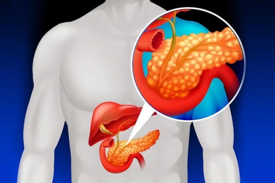 المضاعفات المحتملة بعد جراحة ويبل 2026