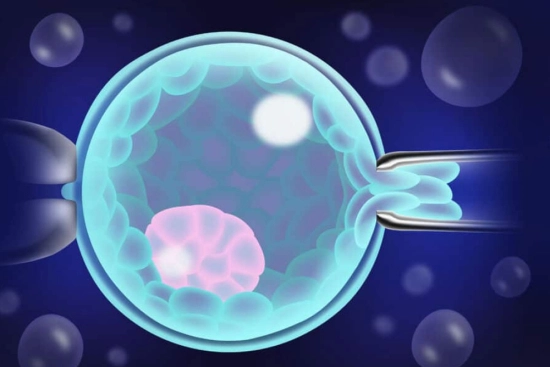 ¿Qué es el diagnóstico genético preimplantativo (PDI)? 2026