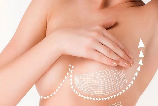 Pourquoi effectuer une chirurgie mamelon ombiliqué en Turquie ?