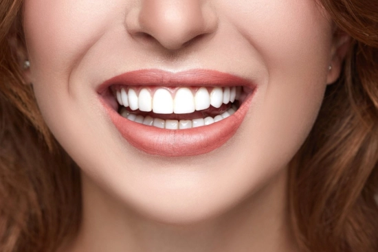 Durability of dental veneers 2026