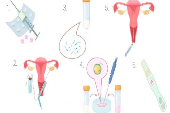 In Vitro Fertilization (IVF) Turkey Istanbul | TOP 3 Clinics & Prices🥇