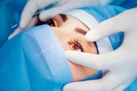 Eye surgical procedure