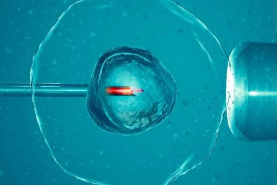 интрацитоплазматическая инъекция сперматозоида Турция 