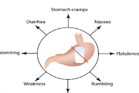 Lactose intolerance treatment Turkey 