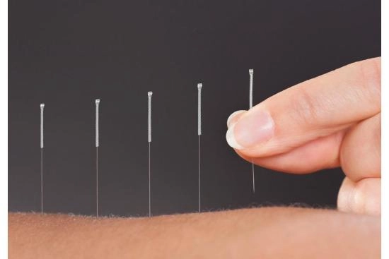 Acupuncture in Turkey