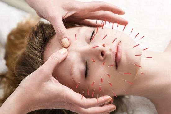 Acupuncture en Turquie